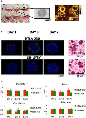 Cell-Laden Hydrogel as a Clinical-Relevant 3D Model for Analyzing Neuroblastoma Growth, Immunophenotype, and Susceptibility to Therapies